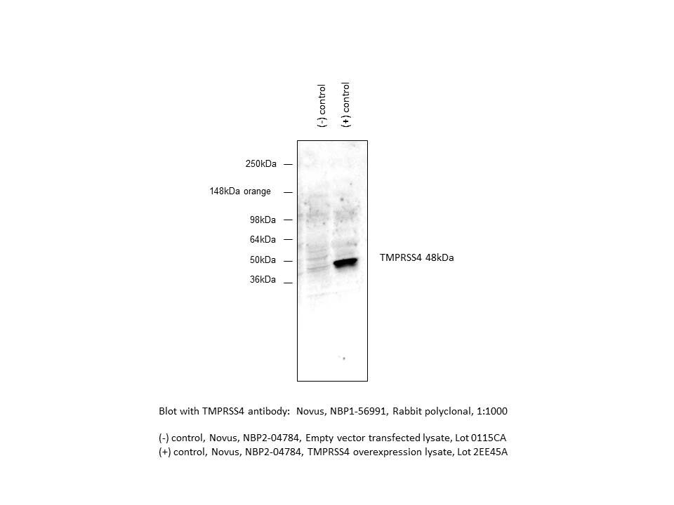 TMPRSS4 Overexpression Lysate NBP2-04784