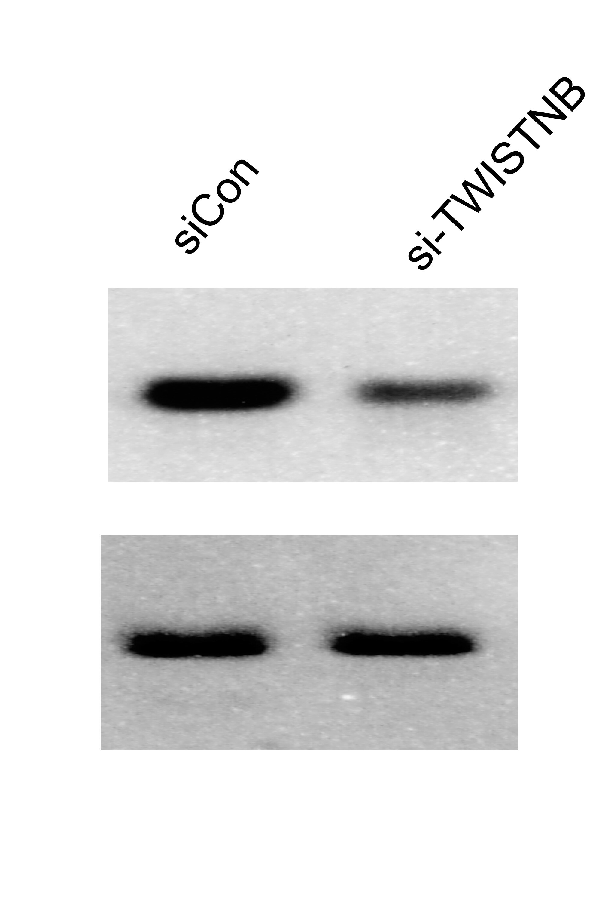 TWISTNB Antibody - BSA Free NBP1-89449