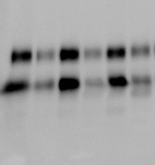 Human/Mouse/Rat TrkB Antibody AF1494