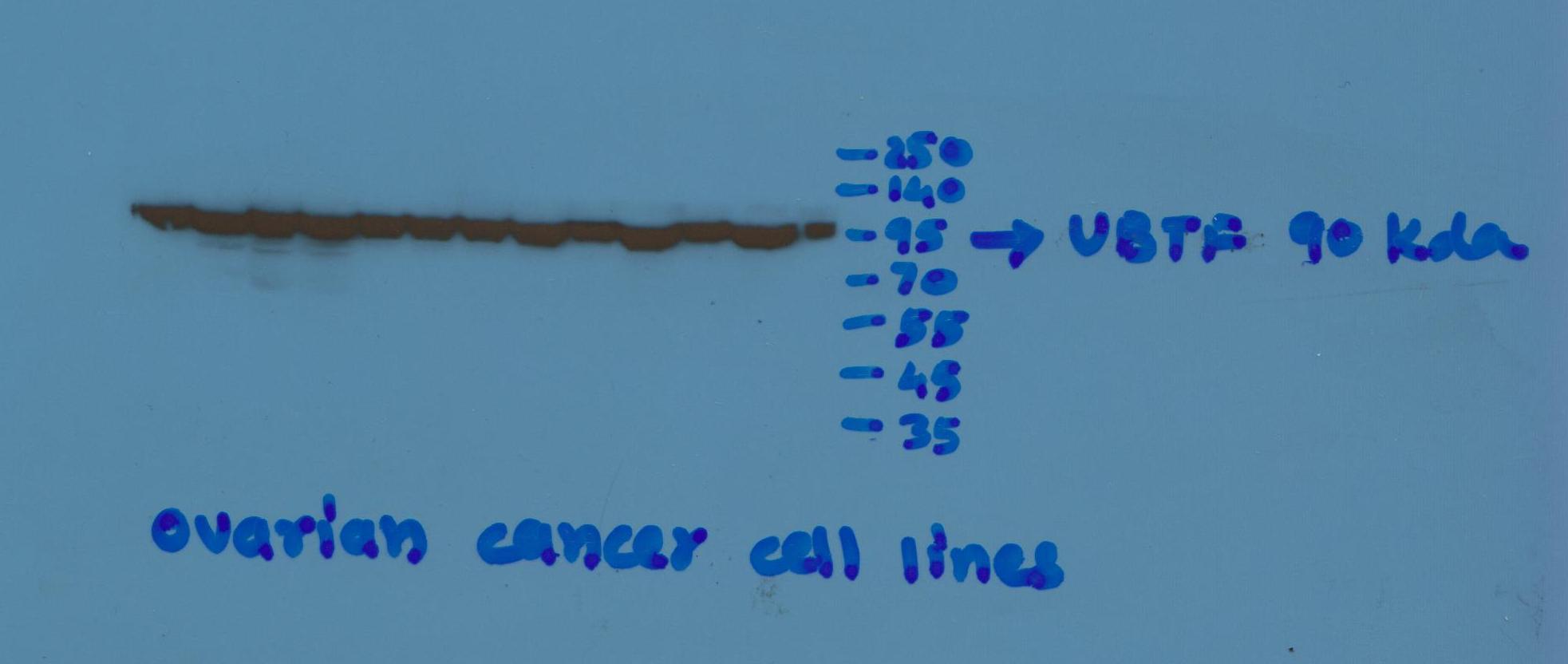 UBTF Antibody - BSA Free NBP1-82545