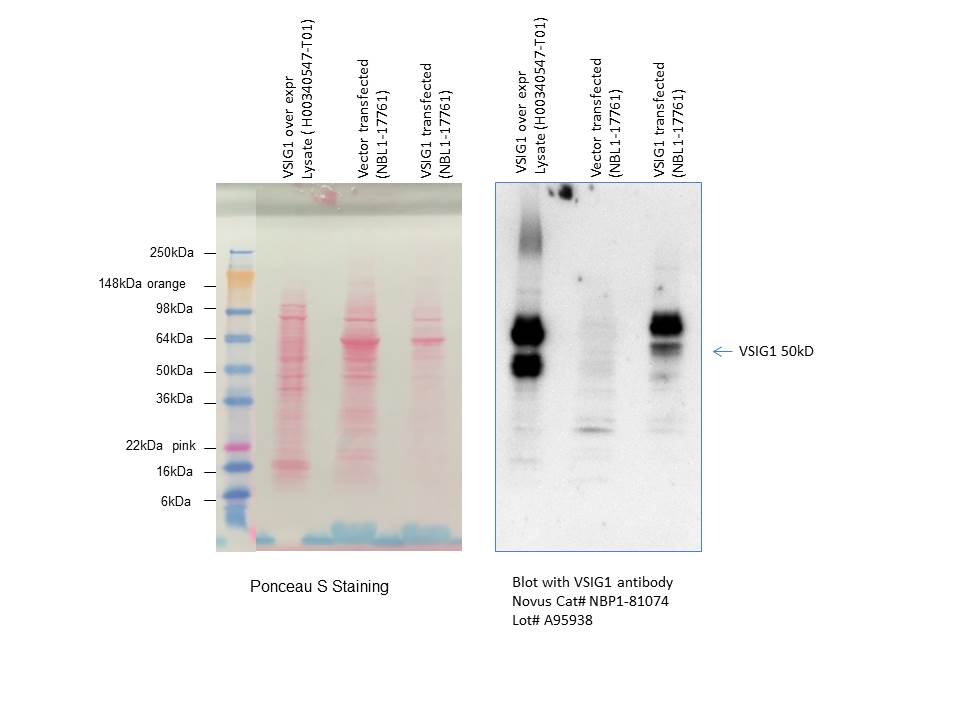 VSIG1 Antibody - BSA Free NBP1-81074