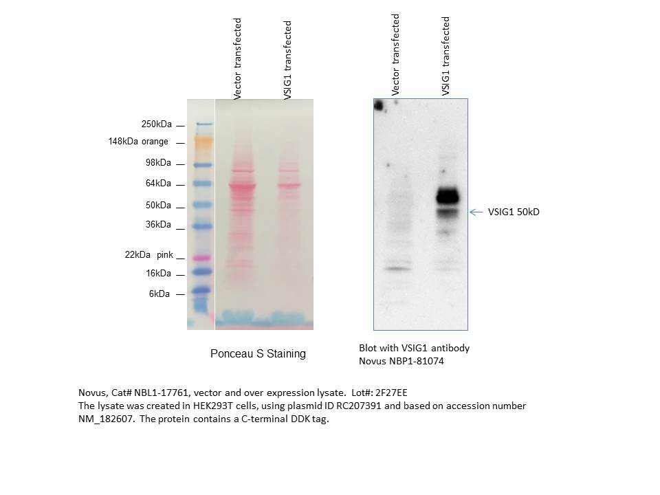 VSIG1 Overexpression Lysate NBL1-17761