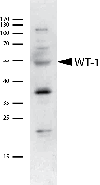 WT1 Antibody (6F-H2) - BSA Free NB110-60011