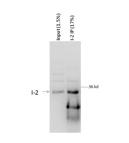 Human/Mouse/Rat PP1 Inhibitor‑2 Antibody AF4719