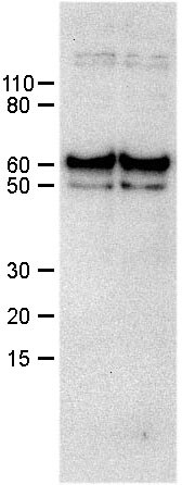 PINK1 Antibody - BSA Free BC100-494