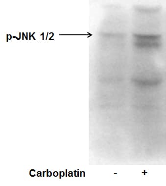 Human/Mouse/Rat Phospho-JNK (T183/Y185) Antibody MAB1205