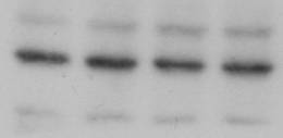 Human MDM2/HDM2 Antibody MAB1244