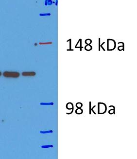 Human/Mouse/Rat Vinculin Antibody MAB6896