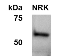 Human Fascin Antibody MAB7745