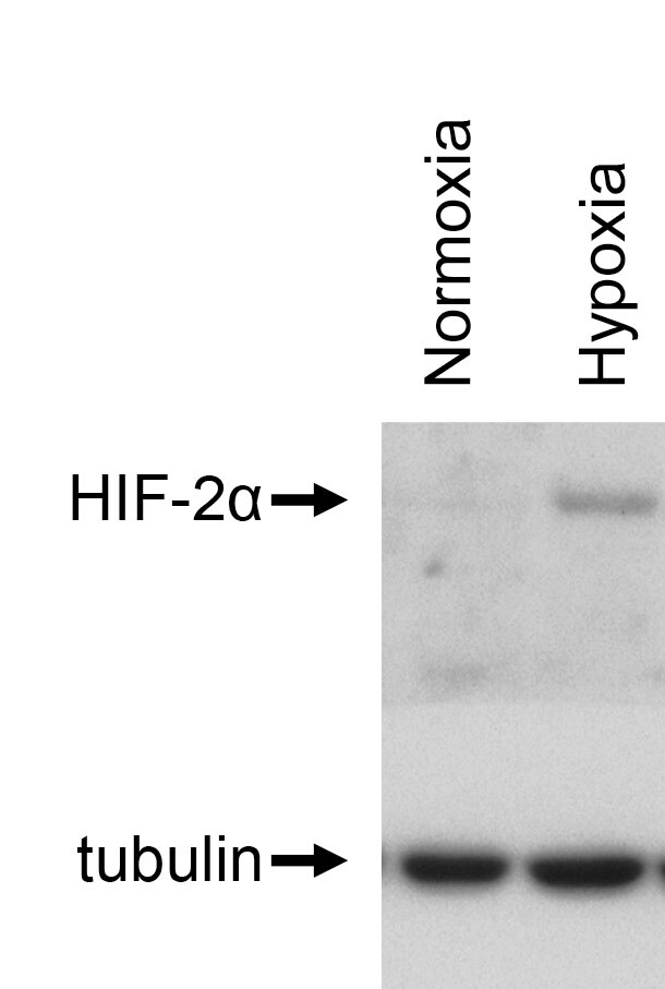 HIF-2 alpha/EPAS1 Antibody (ep190b) NB100-132