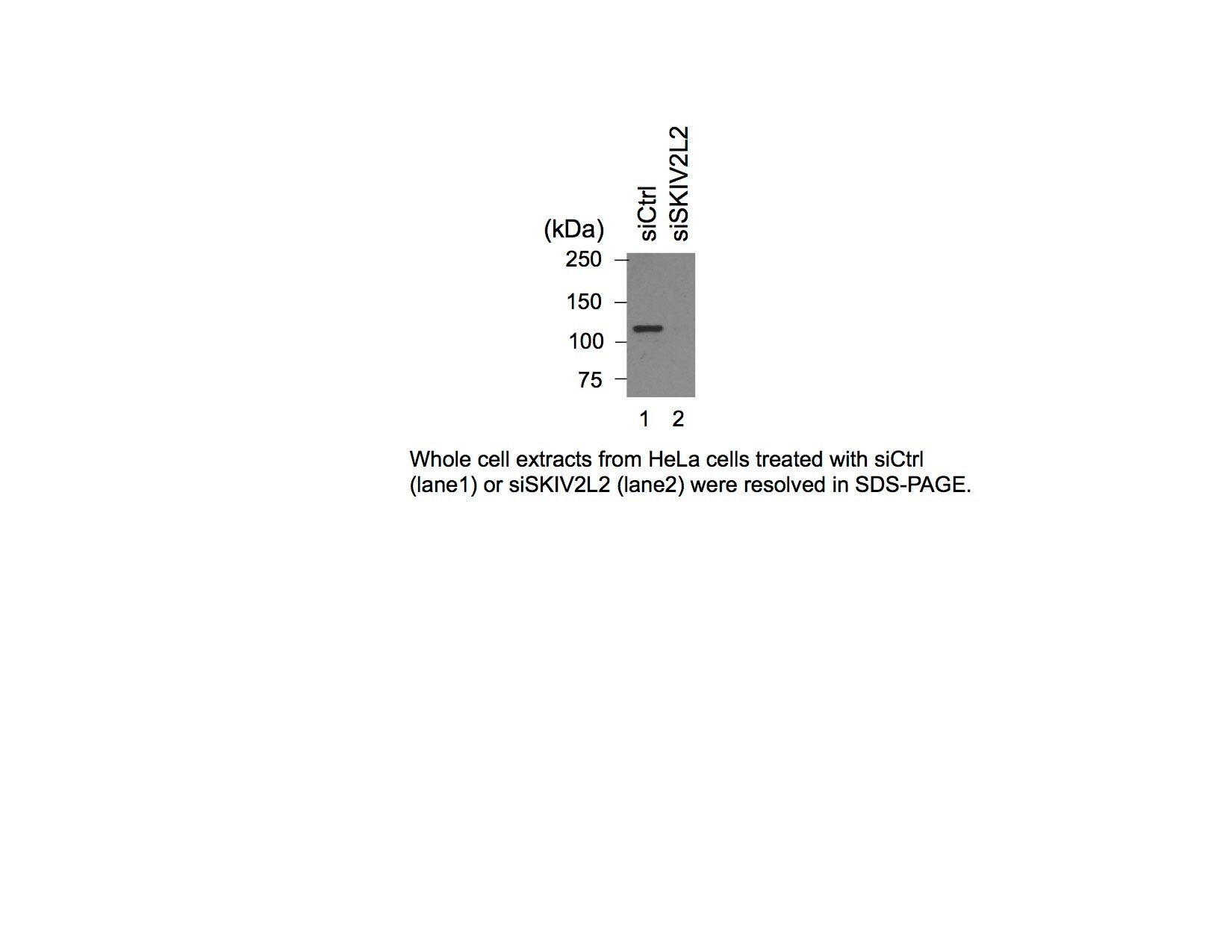 SKIV2L2 Antibody NB100-1574