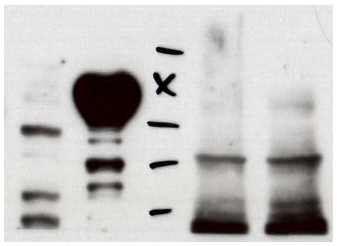 SMN Antibody (2B1) [Alexa Fluor® 647] NB100-1936AF647