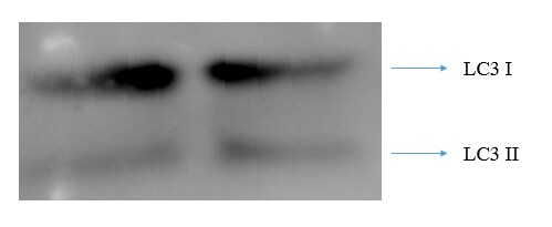 LC3B Antibody - BSA Free NB100-2220