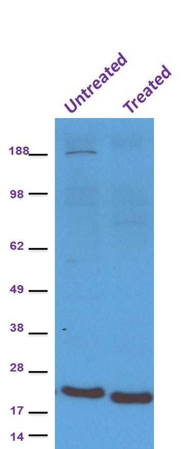 IRE1 alpha [p Ser724] Antibody [HRP] NB100-2323H