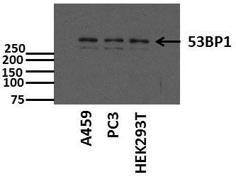 53BP1 Antibody - BSA Free NB100-305