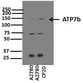 ATP7b Antibody - BSA Free NB100-360