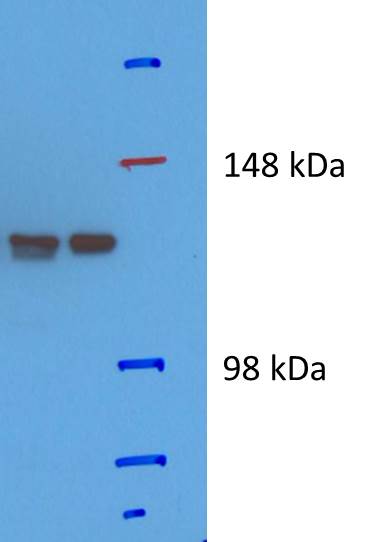 SF3B2 Antibody NB100-79847