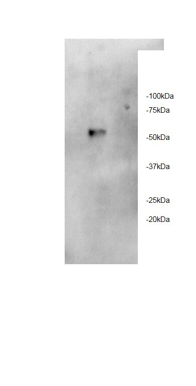 RAR beta/NR1B2 Antibody (336) - Azide Free NB200-323