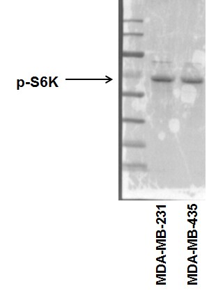 p70 S6 Kinase/S6K [p Thr389/412] Antibody - BSA Free NB600-1049