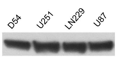 beta-Actin Antibody (AC-15) NB600-501
