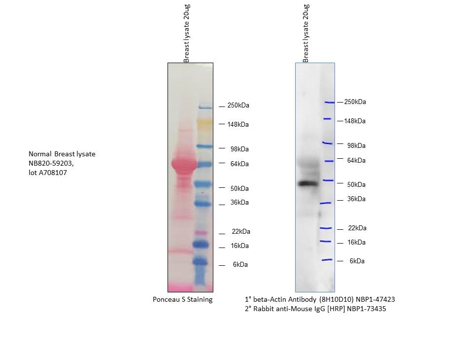 Human Breast Whole Tissue Lysate (Adult Whole Normal) NB820-59203