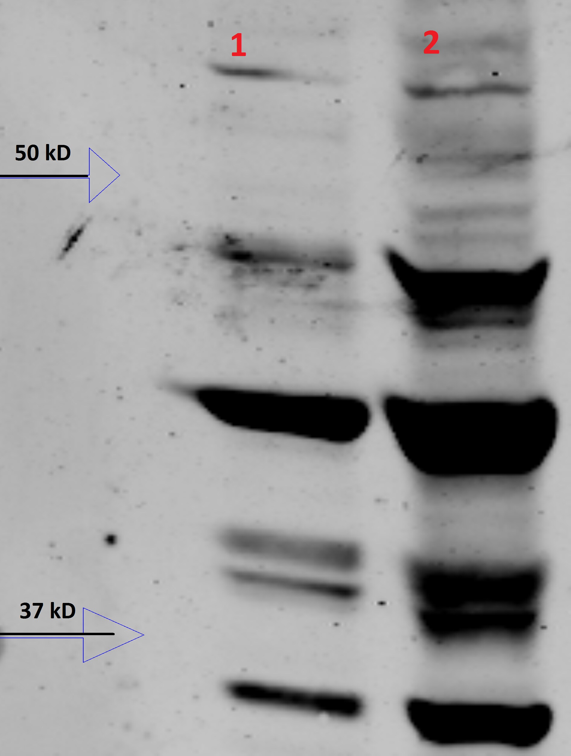 Serpin E1/PAI-1 Antibody - BSA Free NBP1-19773