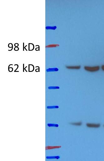 CKAP4/p63 Antibody NBP1-26643