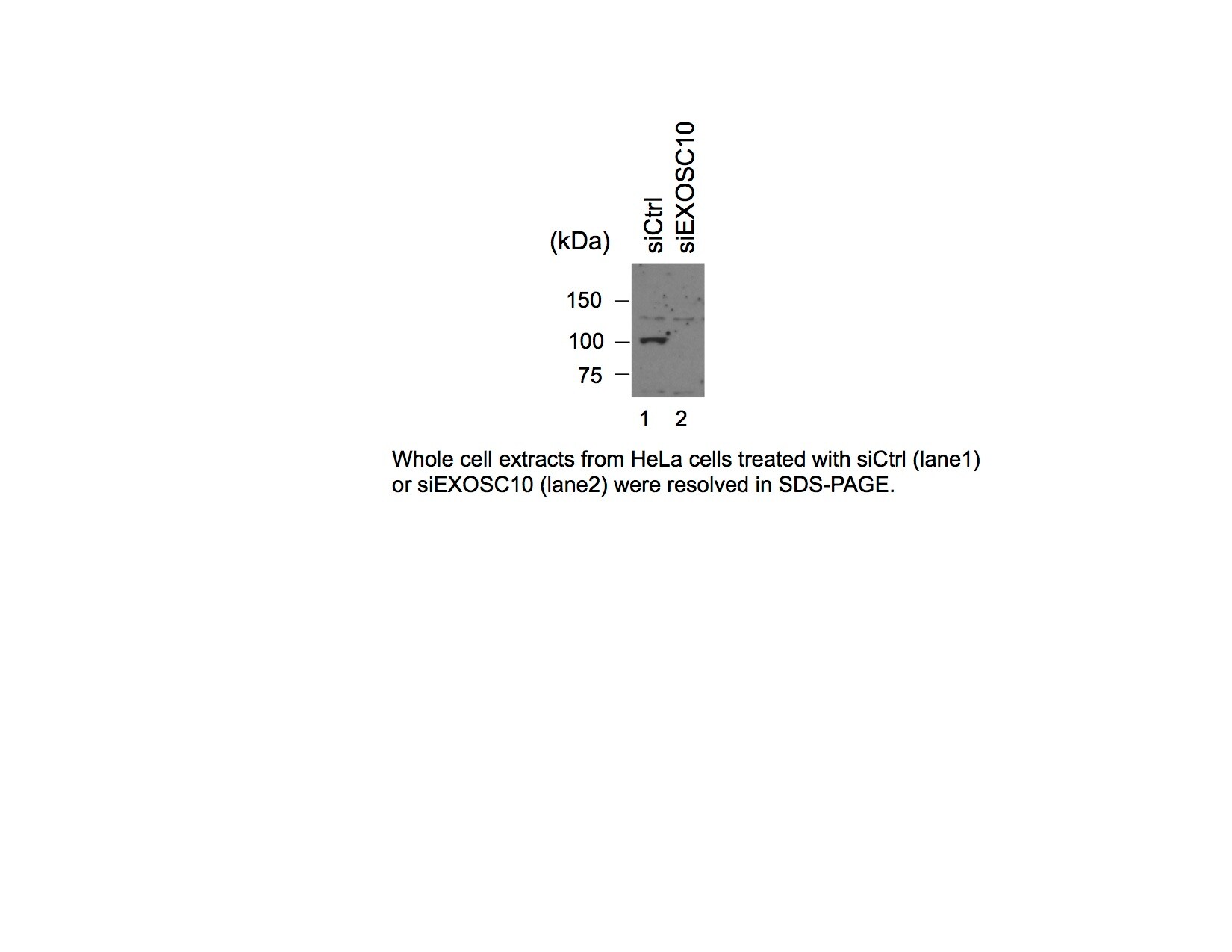 Exosome component 10 Antibody - BSA Free NBP1-32870