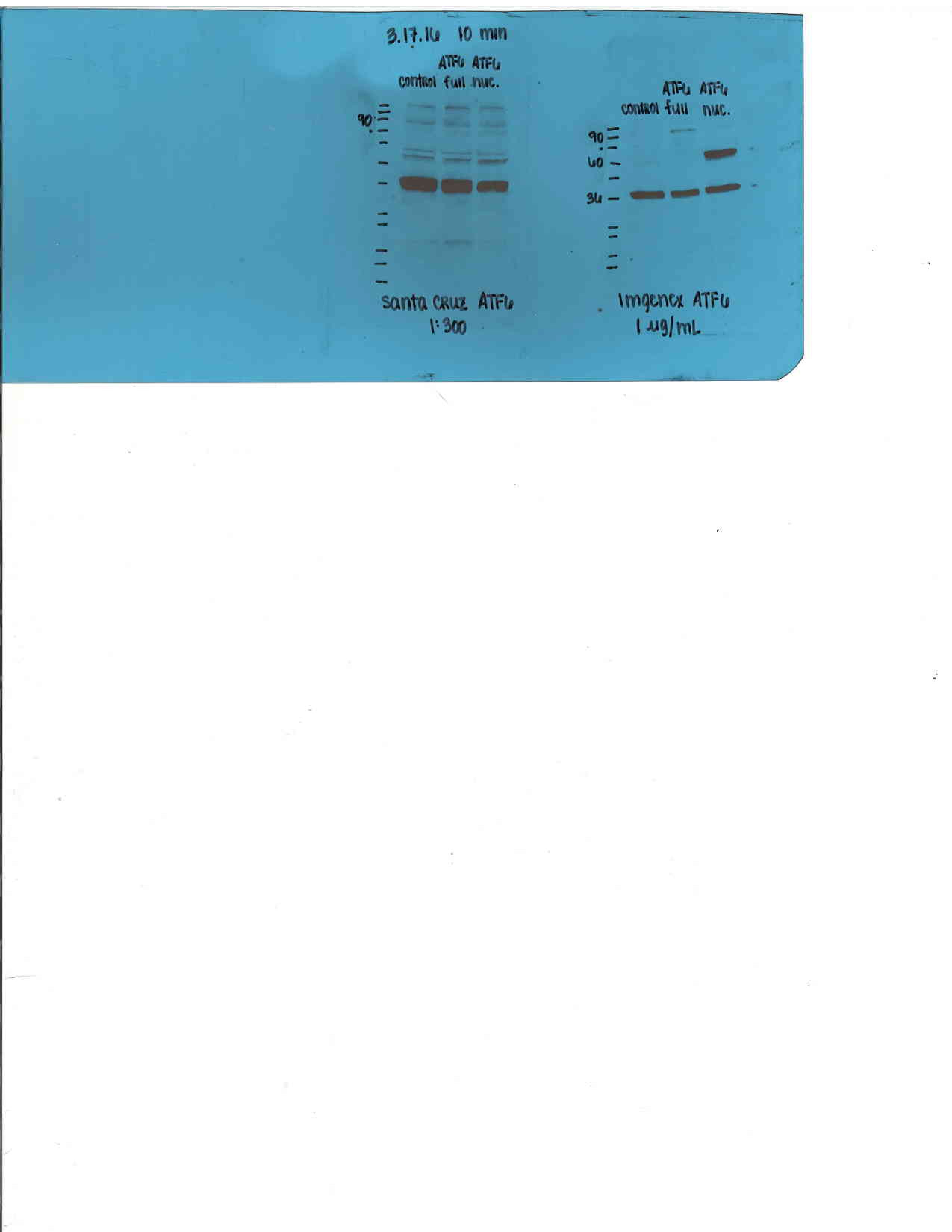 ATF6 Antibody (70B1413.1) - BSA Free NBP1-40256