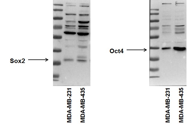 Pluripotent Stem Cell Transcription Factor Antibody Pack NBP1-42823