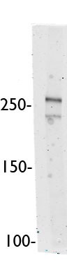 Ankyrin 1 Antibody - BSA Free NBP1-71805