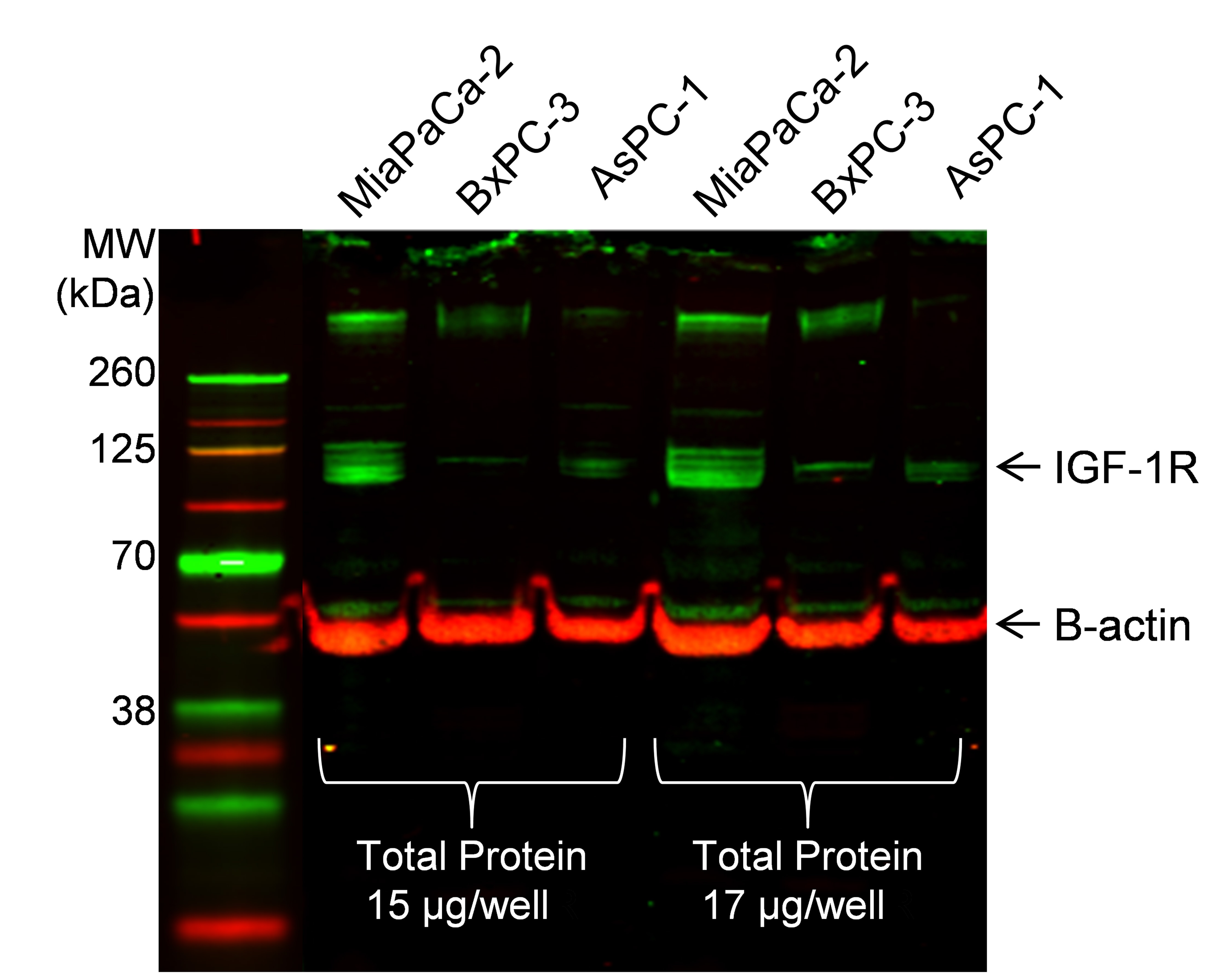 IGF-I R/IGF1R Antibody - BSA Free NBP1-77680