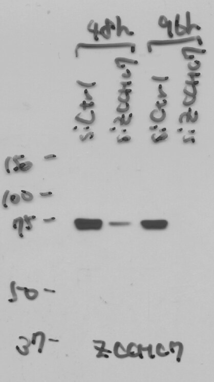 ZCCHC7 Antibody - BSA Free NBP1-89175