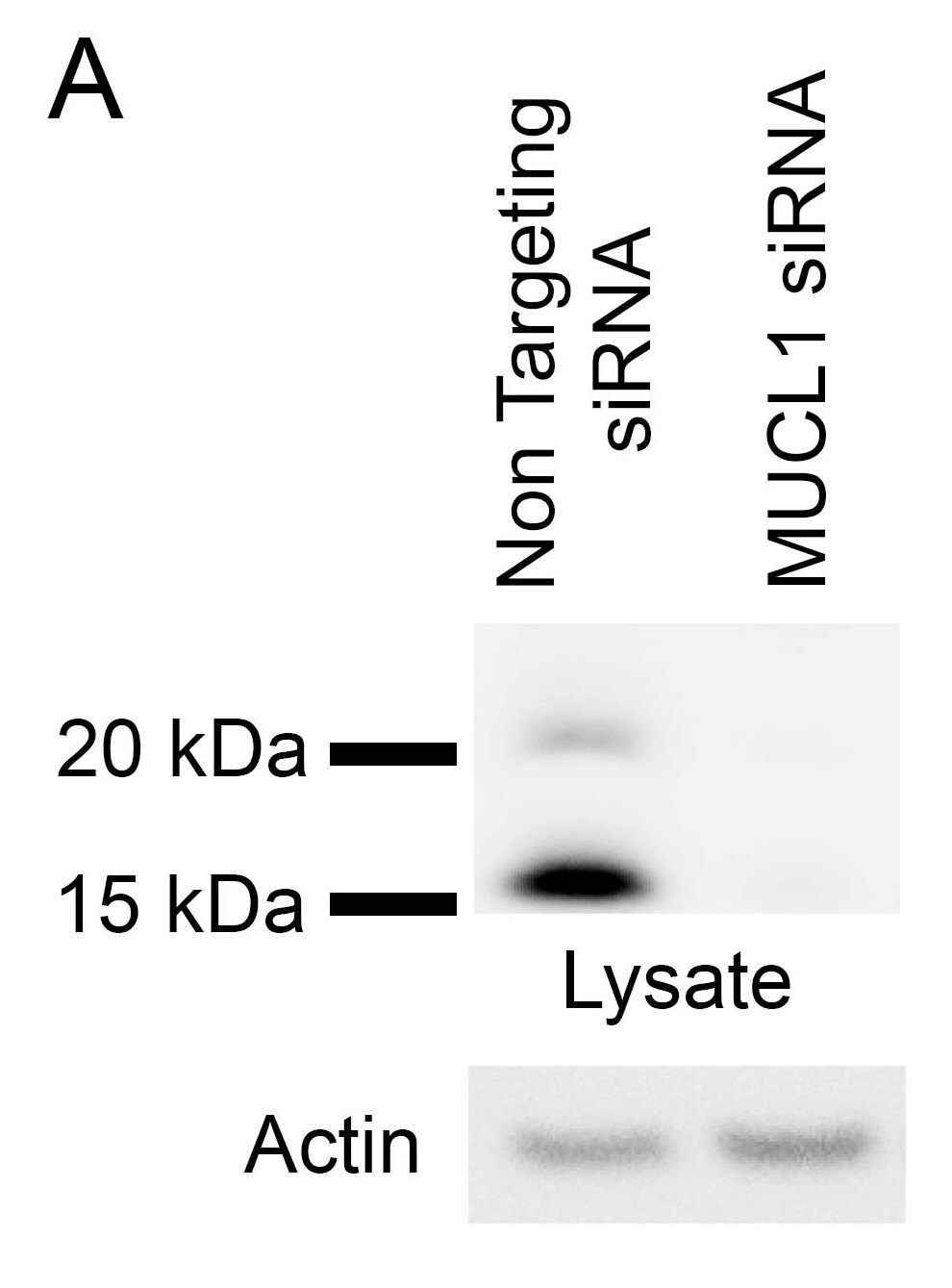 SBEM Antibody - BSA Free NBP1-92366