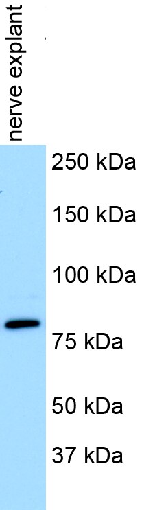 ChABC Antibody (1E10) [Biotin] NBP1-96141B