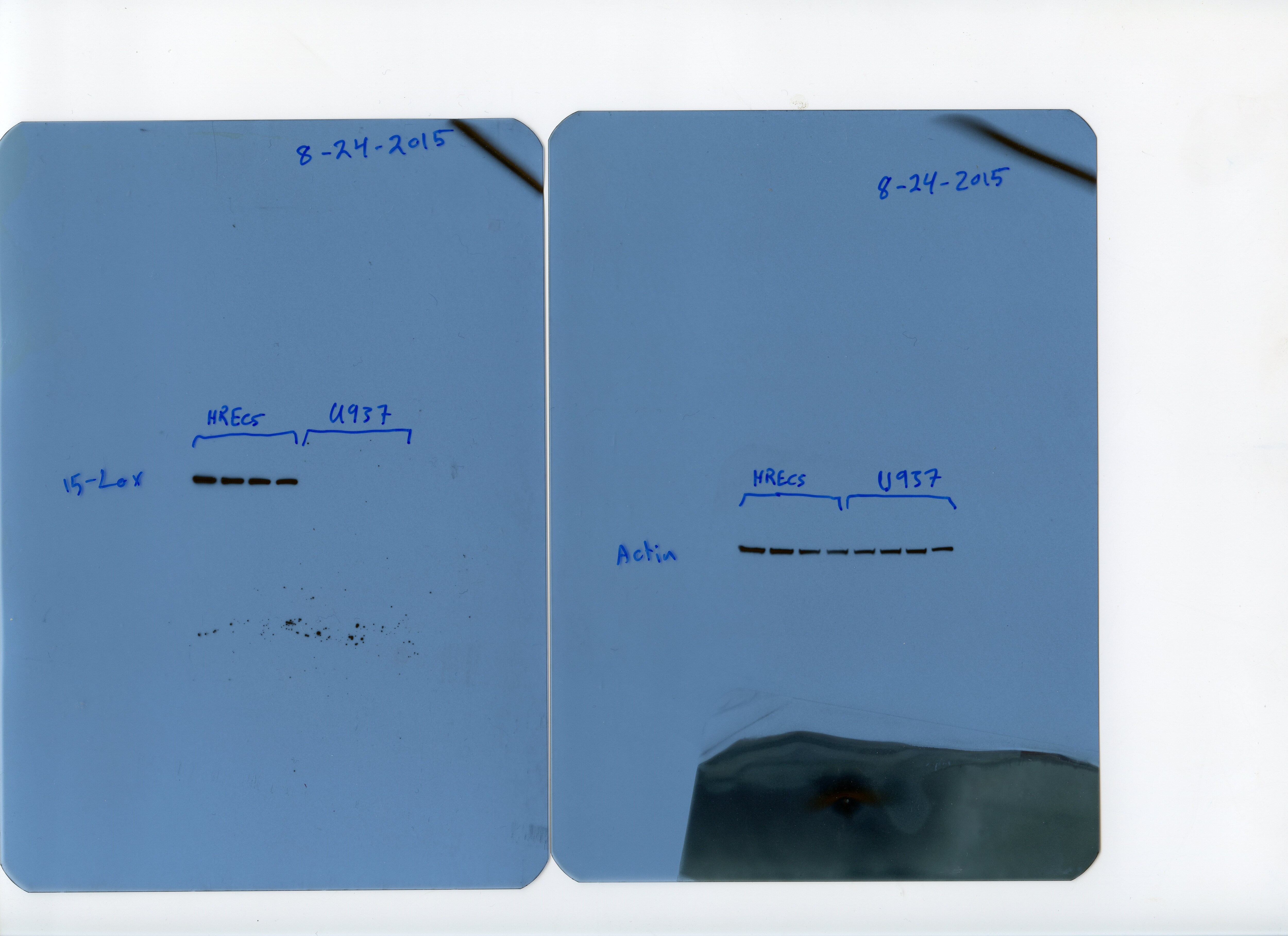 15-Lipoxygenase 1 Antibody (OTI3G8) NBP2-01740