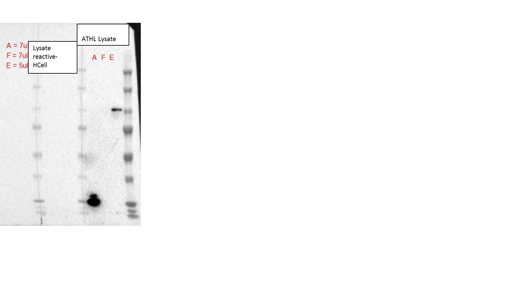 ATHL1 Overexpression Lysate NBP2-06241