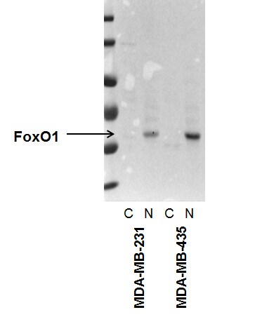 FoxO1/FKHR Antibody (3B6) - BSA Free NBP2-22190