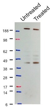 YLPM1 Antibody - BSA Free NBP2-22326