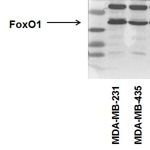 FoxO1/FKHR Antibody (83N7F8) - BSA Free NBP2-31376
