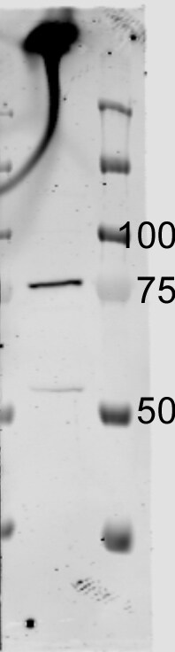 Muscle Phosphofructokinase/PFKM/PFK-1 Antibody - BSA Free NBP2-32169