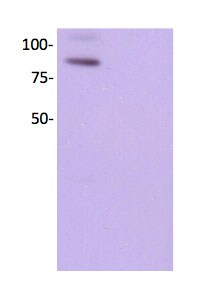 VCAM-1/CD106 Antibody (1.4C3) [HRP] NBP2-33182H