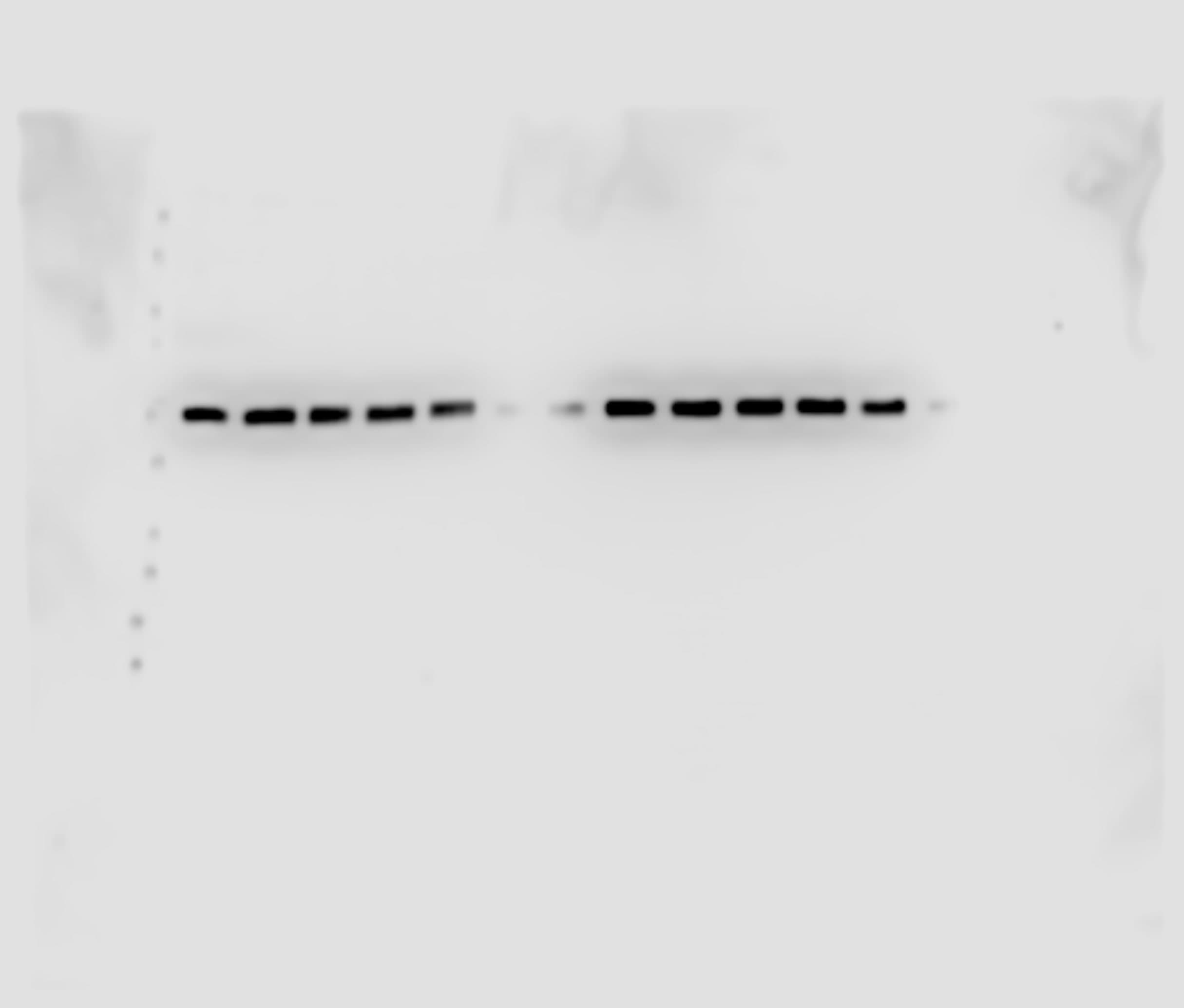 alpha Tubulin Antibody (DM1A) - BSA Free NB100-690