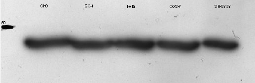 beta-Actin Antibody (AC-15) NB600-501