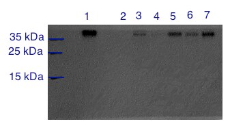gamma Sarcoglycan Antibody - BSA Free NBP1-59744