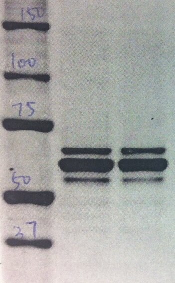 hnRNP L Antibody (4D11) - BSA Free NB120-6106