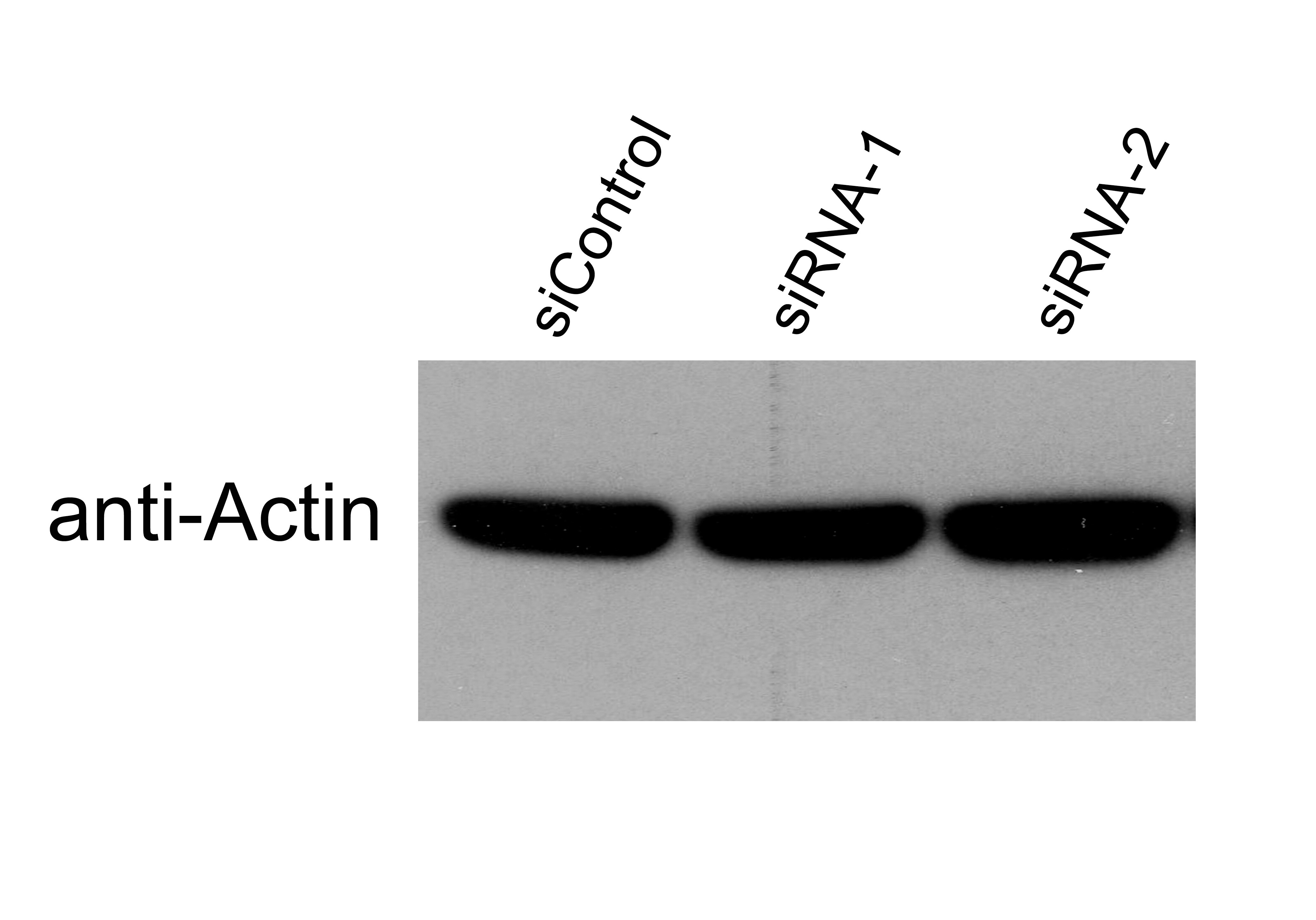 pan Actin Antibody (AC-40) NB120-11003