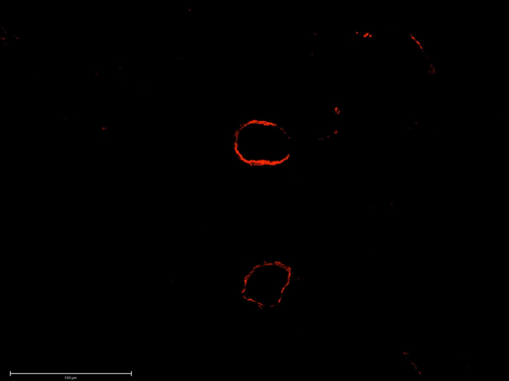 Human/Mouse/Rat  alpha ‑Smooth Muscle Actin Antibody MAB1420