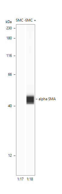 Human/Mouse/Rat  alpha ‑Smooth Muscle Actin Antibody MAB1420