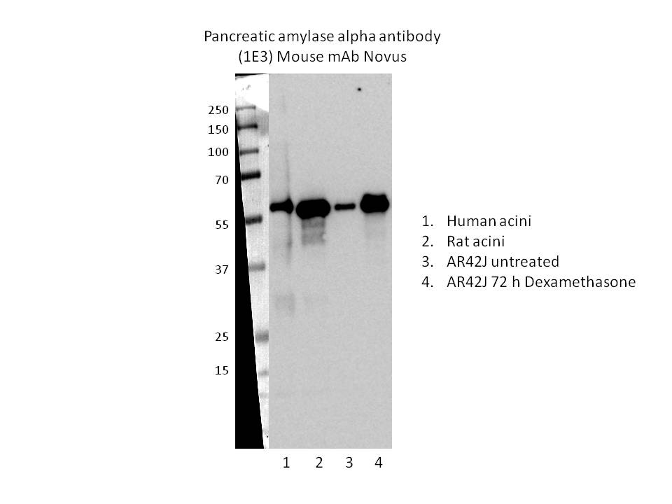 Pancreatic Amylase Alpha Antibody (OTI1E3) NBP2-46518